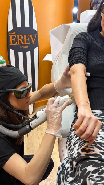 Séance d’épilation laser des bras complets chez EREV Capillaire & Laser à Marseille pour réduire durablement la pilosité et retrouver une peau lisse.