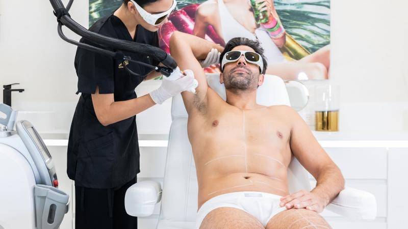 Épilation laser homme avant-bras et mains à Vitrolles pour réduire la densité des poils et améliorer l’esthétique globale avec un rendu naturel.