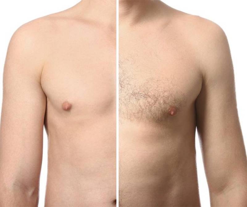 Épilation laser homme torse et ventre à Marseille Borély 13008 près du parc pour un rendu homogène naturel