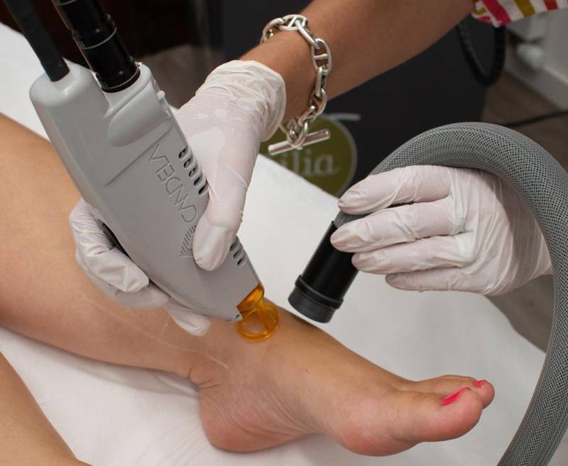 Épilation laser femme pieds et orteils à Marseille Prado 13008 pour une finition esthétique parfaite et une peau lisse durable.