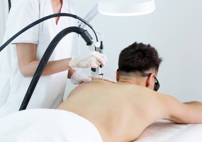 Épilation laser homme épaules à Marseille 13003 Belle de Mai pour éliminer les poils disgracieux et obtenir une finition propre durable