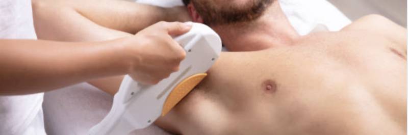 Épilation laser homme bras complets et avant bras à Marseille Vieille Chapelle 13008 pour réduire la densité des poils et obtenir un rendu naturel et homogène.