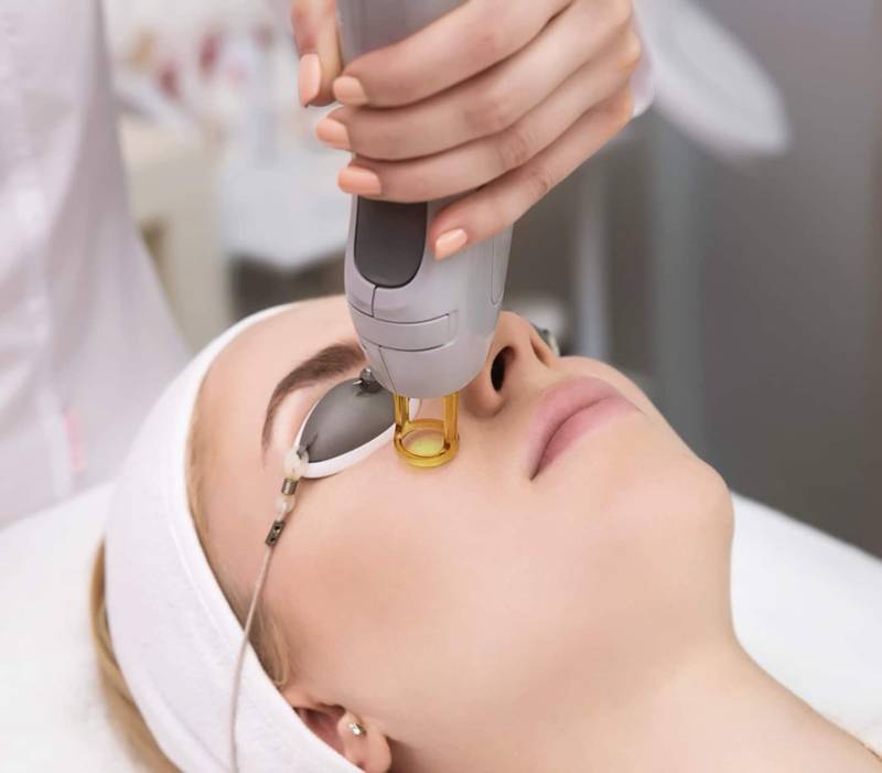 Épilation laser femme inter sourcils et front à Marseille Périer 13008 pour un visage net, sans duvet et un résultat harmonieux.