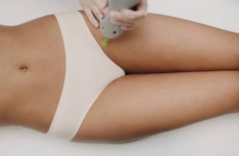 Épilation laser femme maillot classique et aisselles à Marseille Borély 13008 pour une peau nette, douce et sans irritation durable.