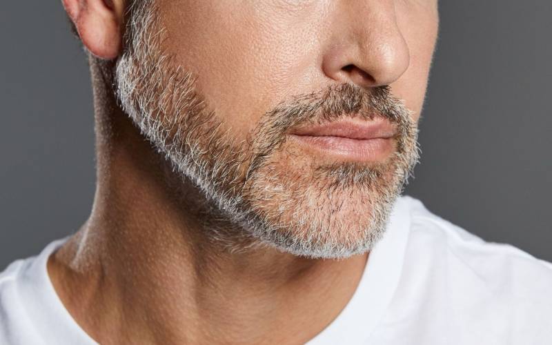 Contour de barbe parfaitement dessiné après épilation laser, pour une ligne nette, précise et sans irritation au niveau du visage et du cou.