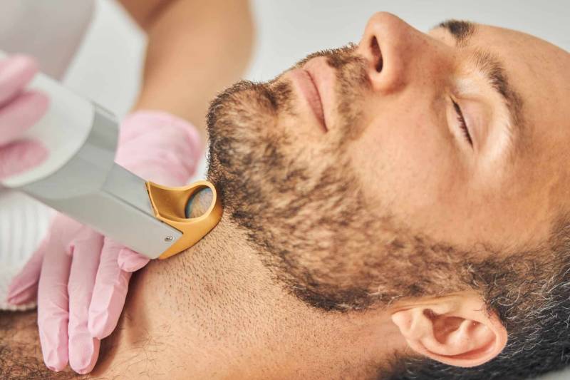 Épilation laser homme tour de cou à Aix-en-Provence pour éviter les irritations et obtenir un contour propre durable et esthétique.