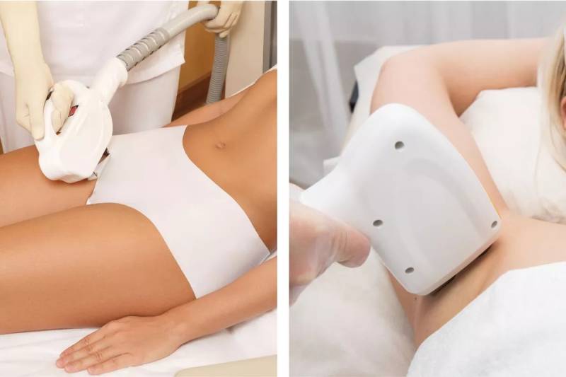 Épilation laser femme sillon inter-fessier à Aubagne pour améliorer l’hygiène intime et réduire durablement la pilosité avec un confort optimal.