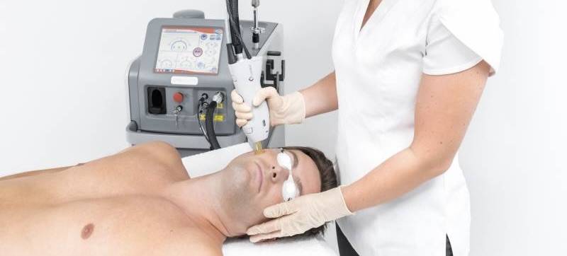 Résultat d’une épilation laser homme nuque et haut du dos à Marseille 13012 Saint-Barnabé : réduction visible des poils et peau plus nette dès les premières séances.