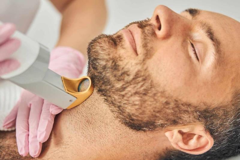 Épilation laser homme nuque à Marseille Périer 13008 pour une finition propre sans irritation après rasage