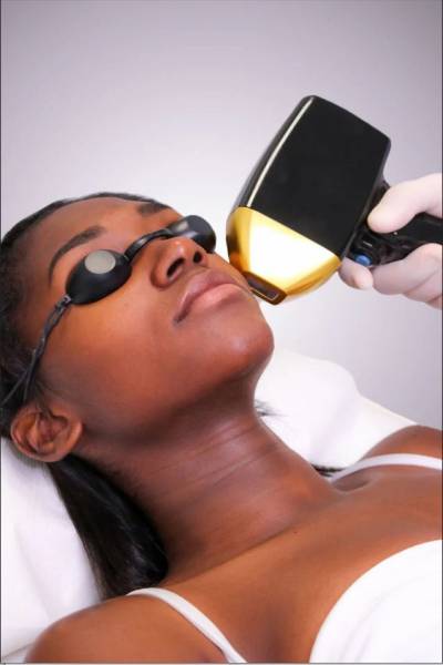 Séance d’épilation laser du menton chez la femme chez EREV Capillaire & Laser à Marseille pour réduire durablement la pilosité du visage.