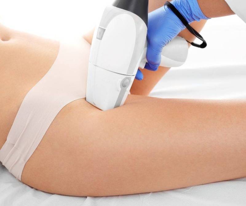 Épilation laser femme maillot intégral à Aubagne : traitement précis pour une peau nette, douce et sans poils incarnés durablement.