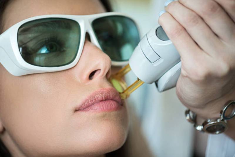 Épilation laser du visage : une solution efficace pour réduire durablement la pilosité et retrouver une peau nette et uniforme.