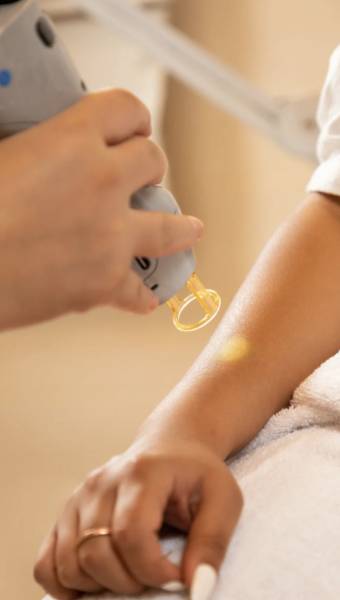 Les erreurs à éviter avant et après une séance d’épilation laser